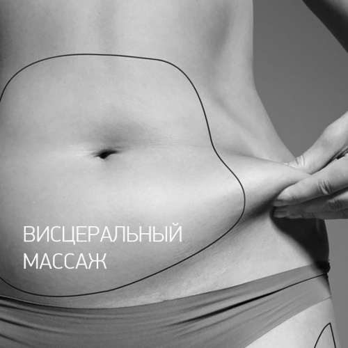 Висцеральная пластика живота